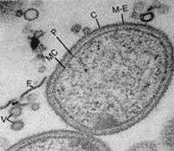 Cellule de Porphyromonas gingivalis vue en microscopie électronique  en transmission